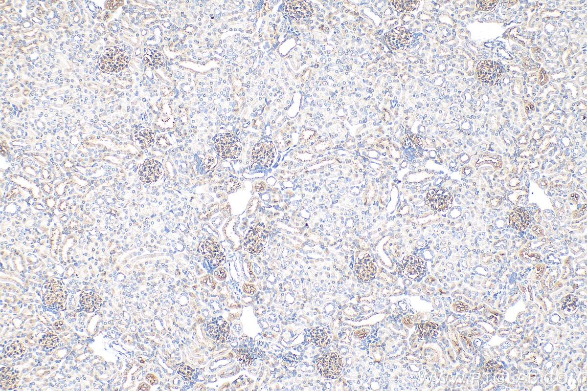 Immunohistochemistry (IHC) staining of mouse kidney tissue using ZO-1 Polyclonal antibody (21773-1-AP)