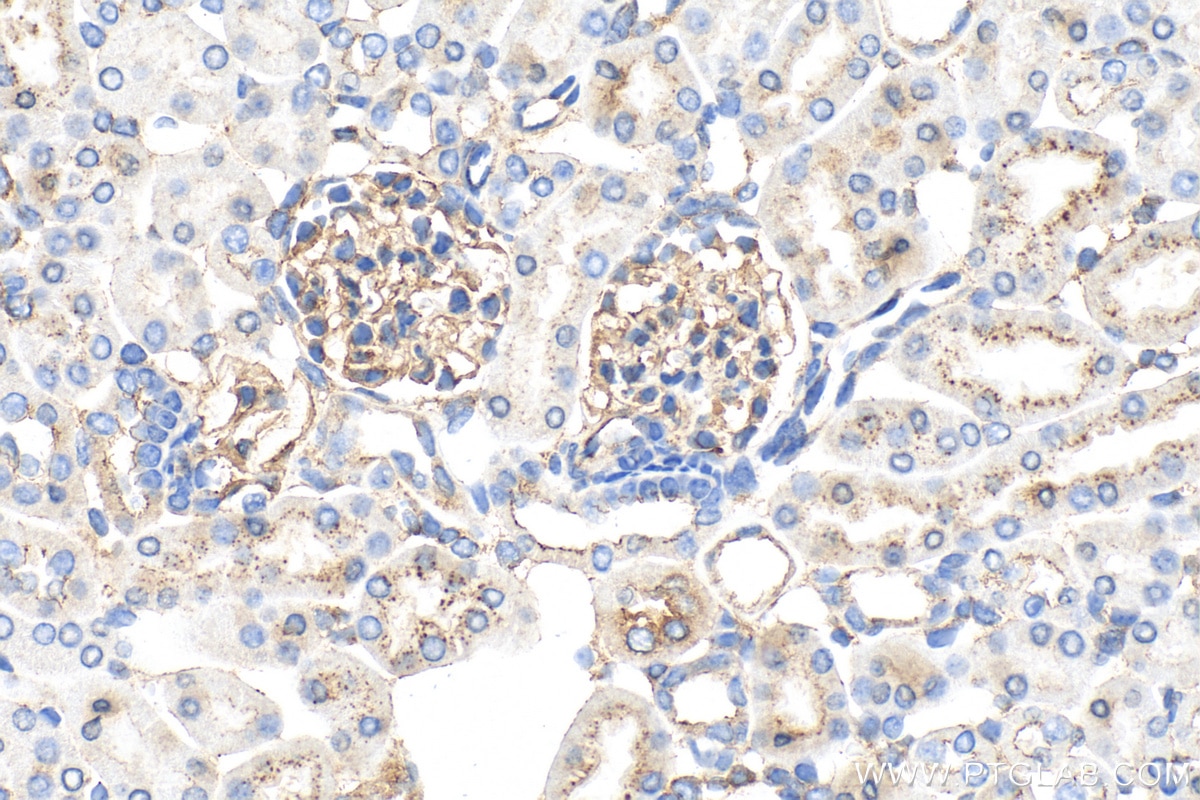 Immunohistochemistry (IHC) staining of mouse kidney tissue using ZO-1 Polyclonal antibody (21773-1-AP)