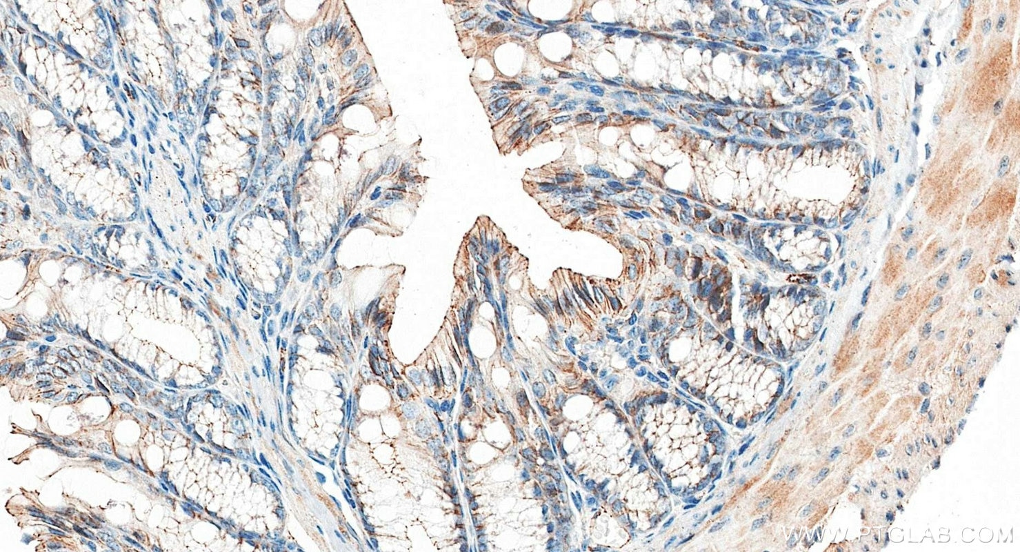 IHC staining of mouse colon using 21773-1-AP Immunohistochemistry (IHC) staining of mouse colon tissue using ZO-1 Polyclonal antibody (21773-1-AP)