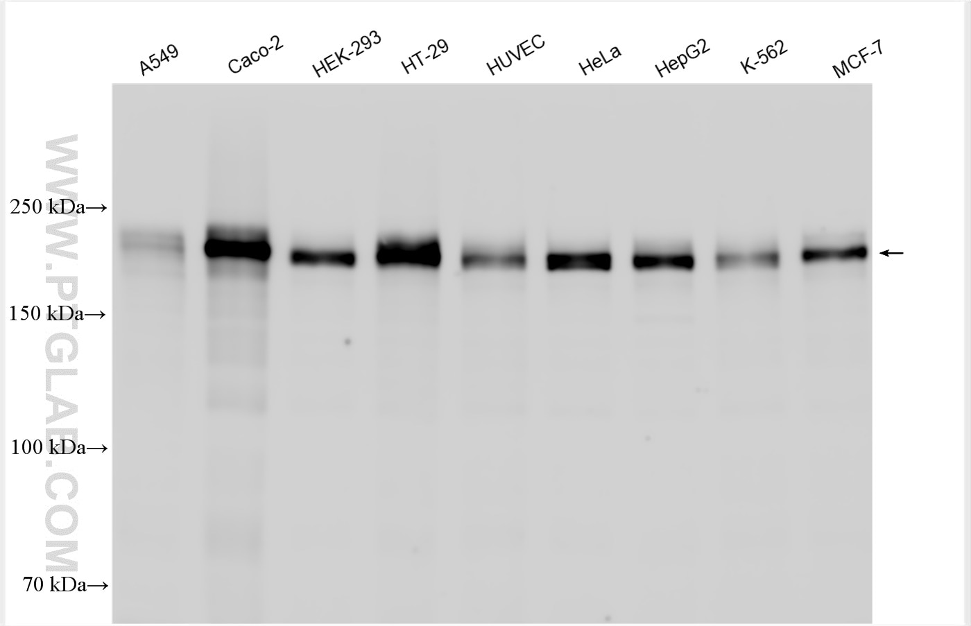 Western Blot (WB) analysis of various lysates using ZO-1 Polyclonal antibody (21773-1-AP)