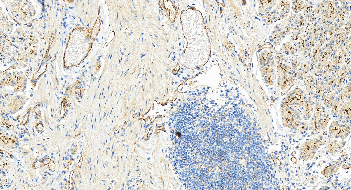 Immunohistochemistry (IHC) staining of human stomach tissue using ZO-1 Polyclonal antibody (30487-1-AP)