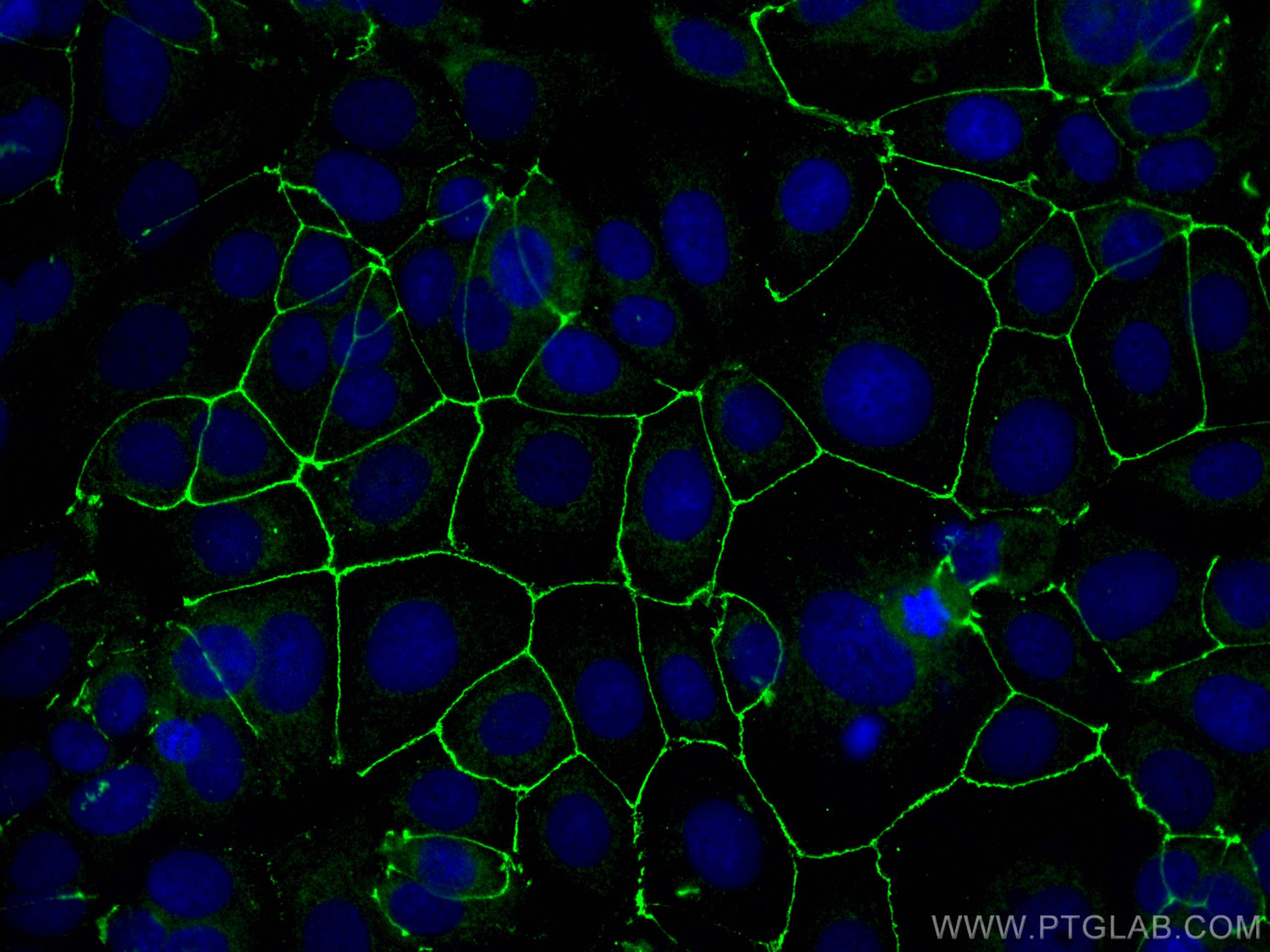 Immunofluorescence (IF) / fluorescent staining of MCF-7 cells using ZO1 Polyclonal antibody (30487-1-AP)