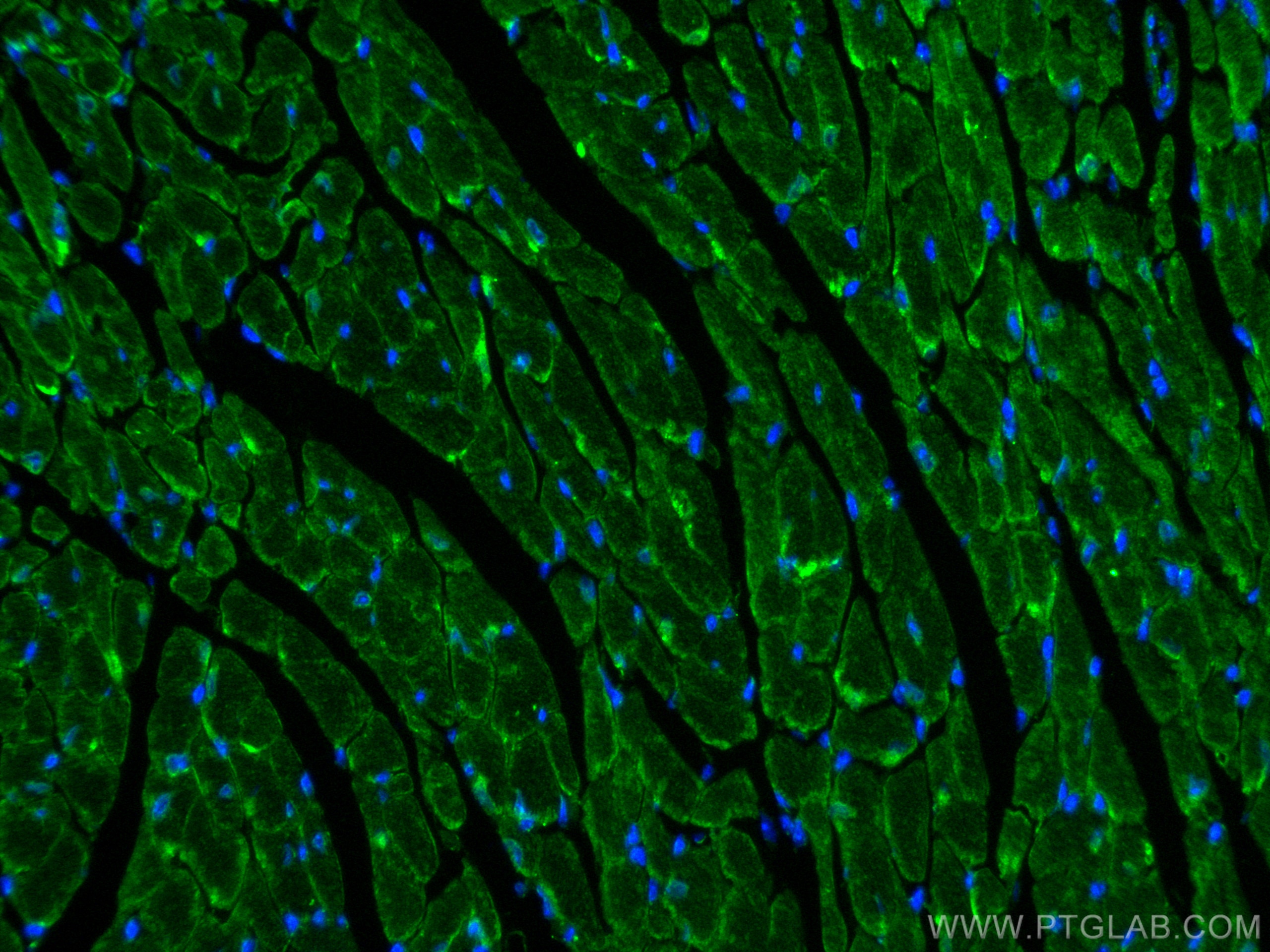 Immunofluorescence (IF) / fluorescent staining of mouse heart tissue using ZO-1 Polyclonal antibody (30487-1-AP)