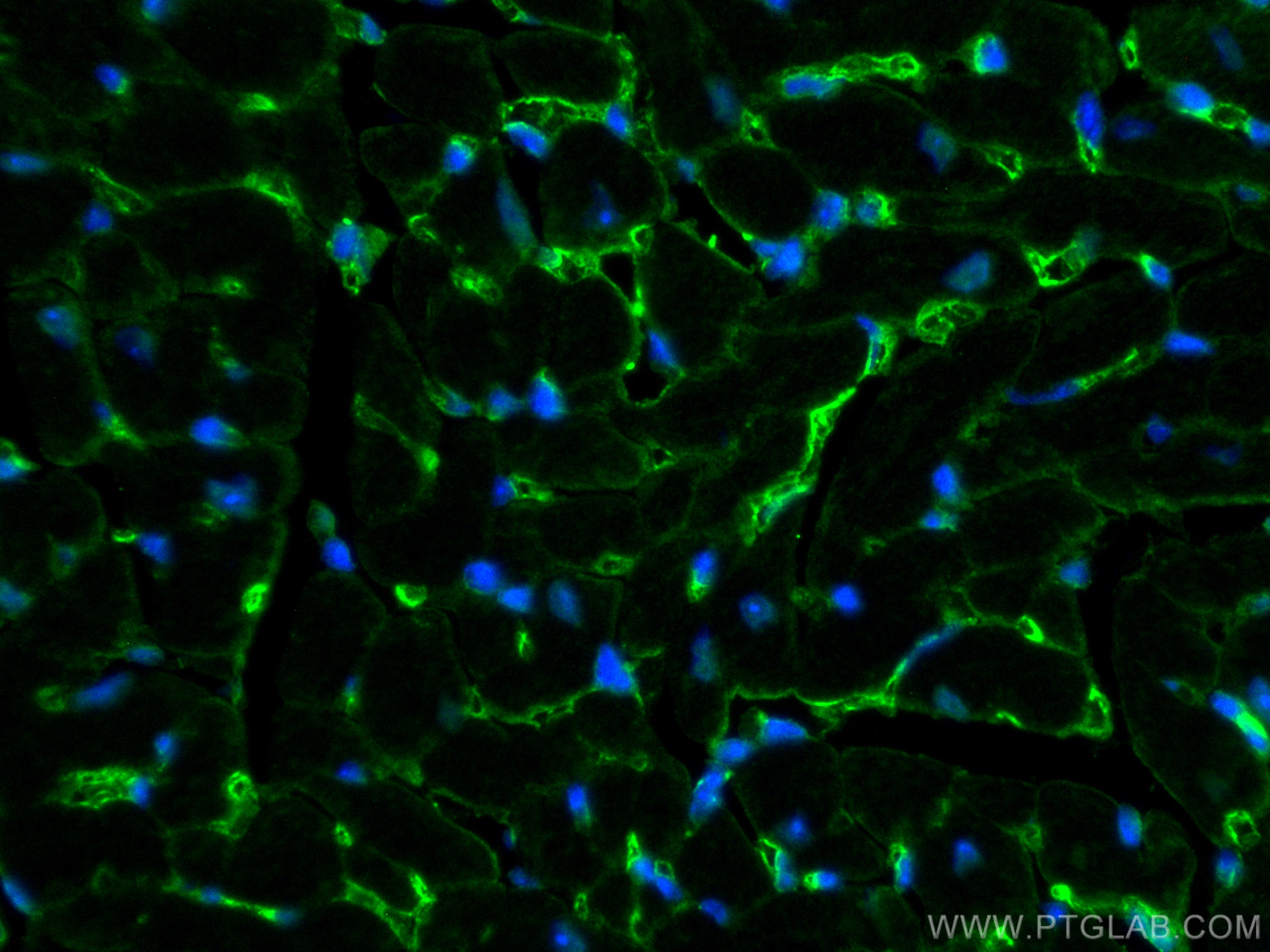 Immunofluorescence (IF) / fluorescent staining of mouse heart tissue using ZO-1 Polyclonal antibody (30487-1-AP)