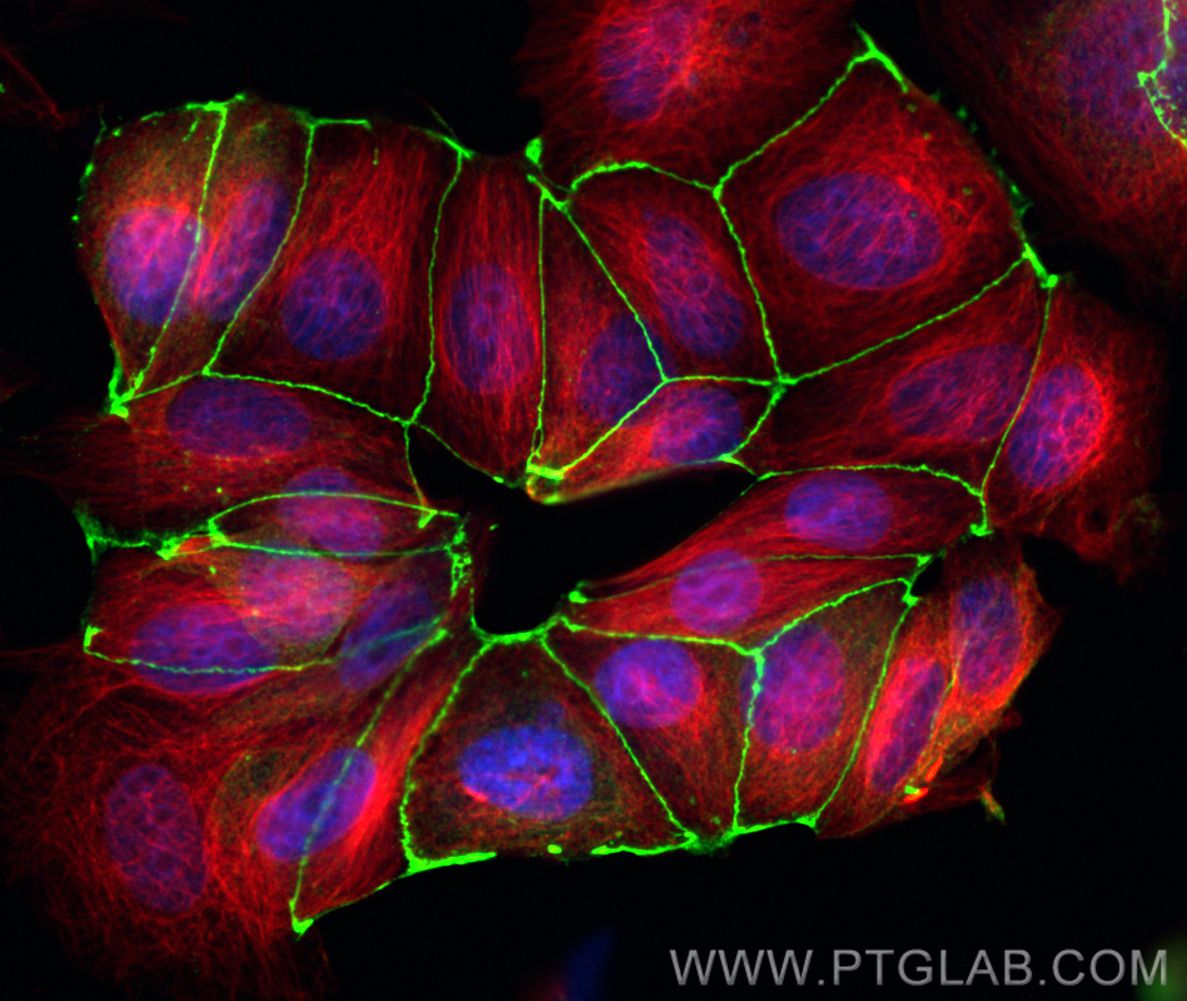 Immunofluorescence (IF) / fluorescent staining of MCF-7 cells using ZO1 Recombinant antibody (82870-1-RR)