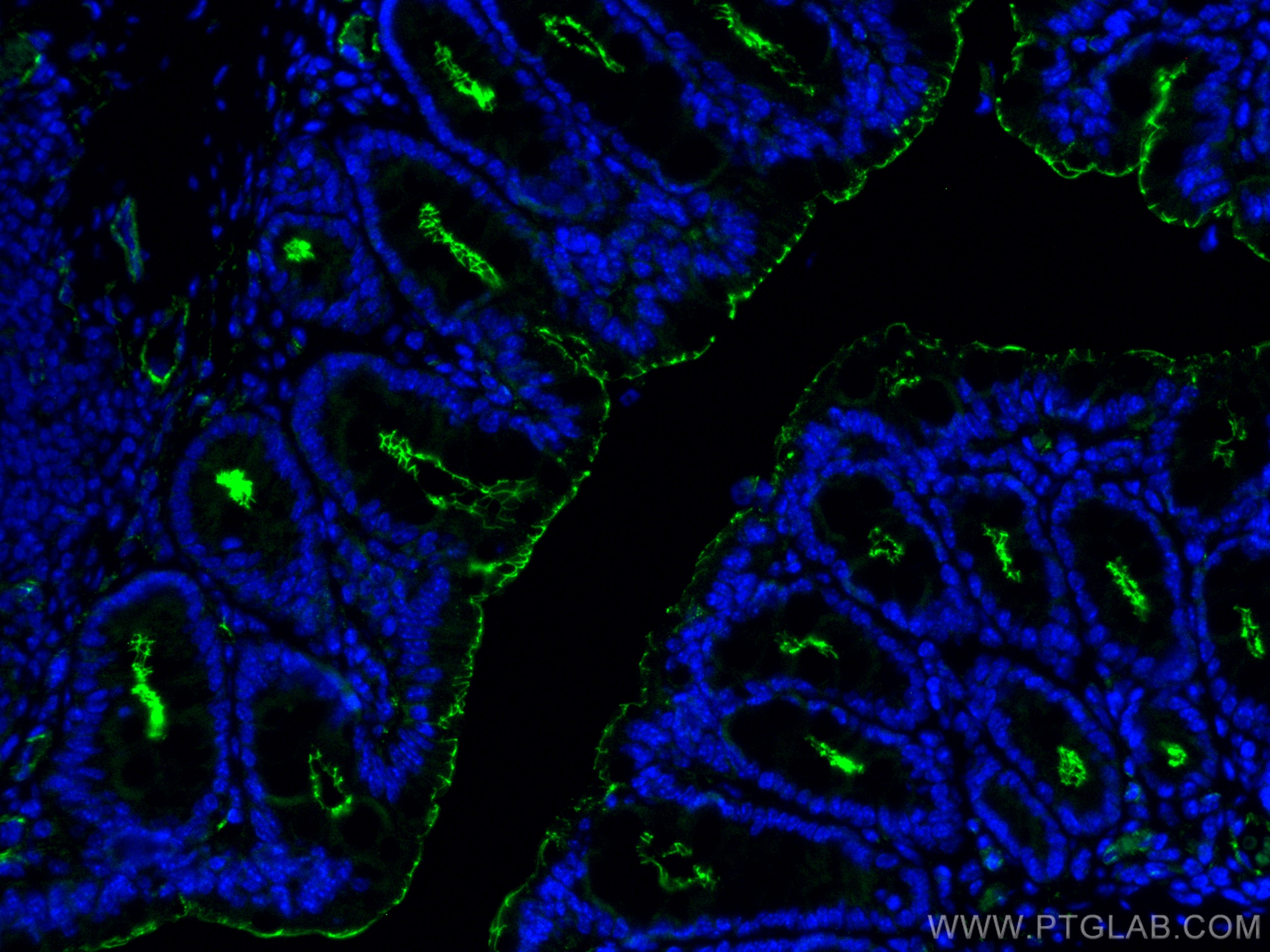Immunofluorescence (IF) / fluorescent staining of mouse colon tissue using ZO-1 Recombinant antibody (82870-7-RR)