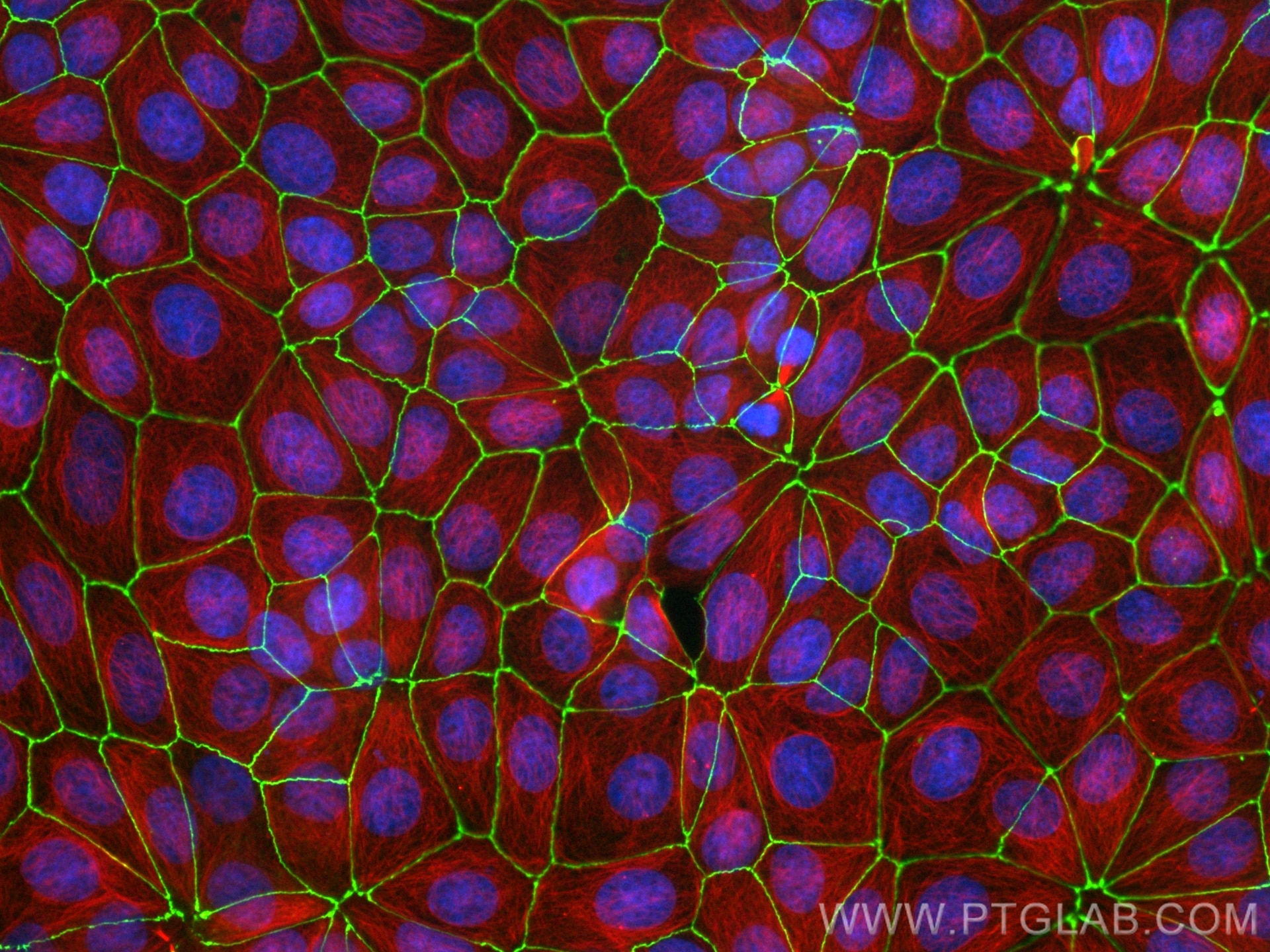 Immunofluorescence (IF) / fluorescent staining of MCF-7 cells using ZO-1 Recombinant antibody (82870-7-RR)
