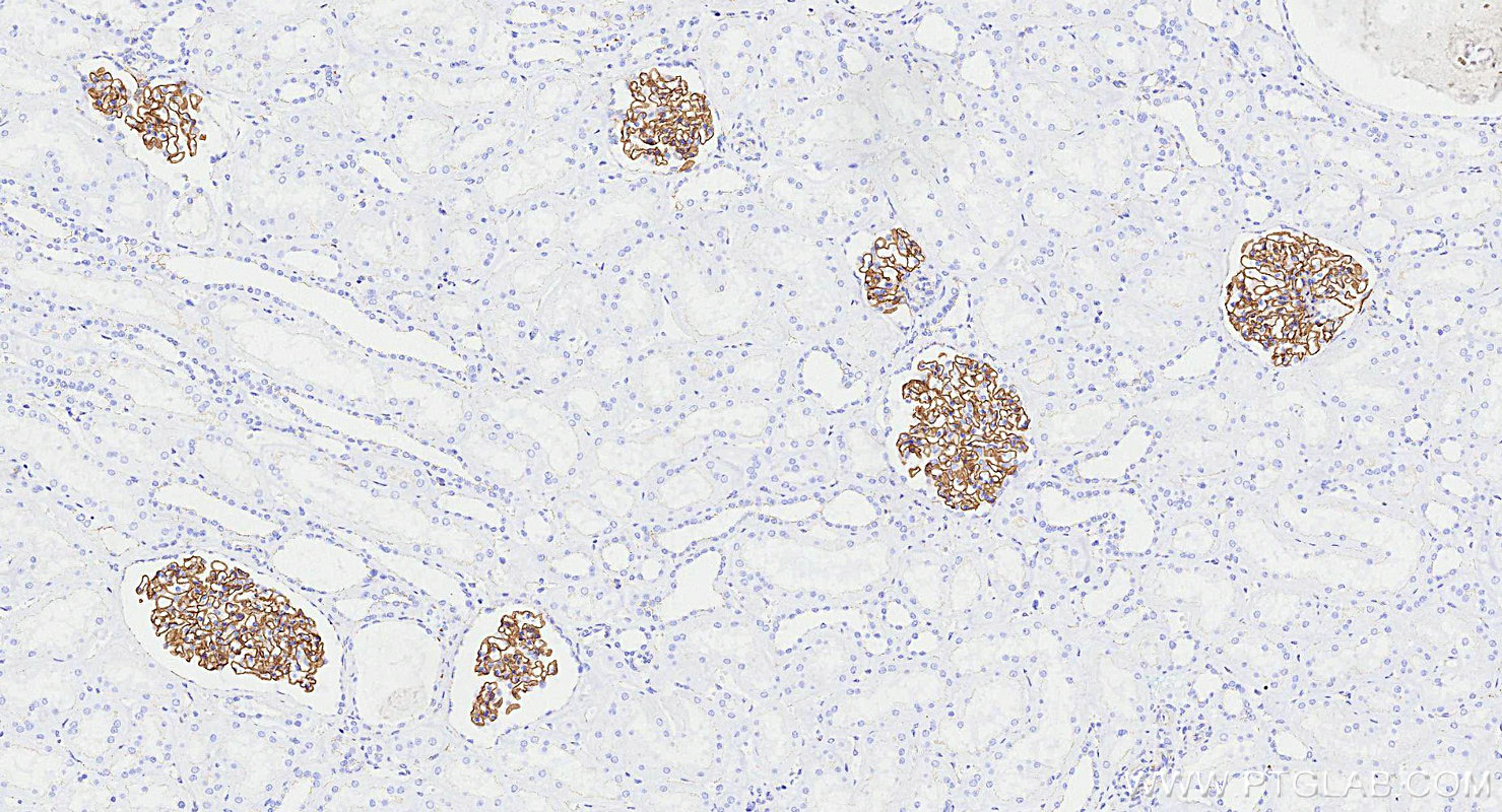 Immunohistochemistry (IHC) staining of human kidney tissue using ZO-1 Recombinant monoclonal antibody (82870-7-RR)