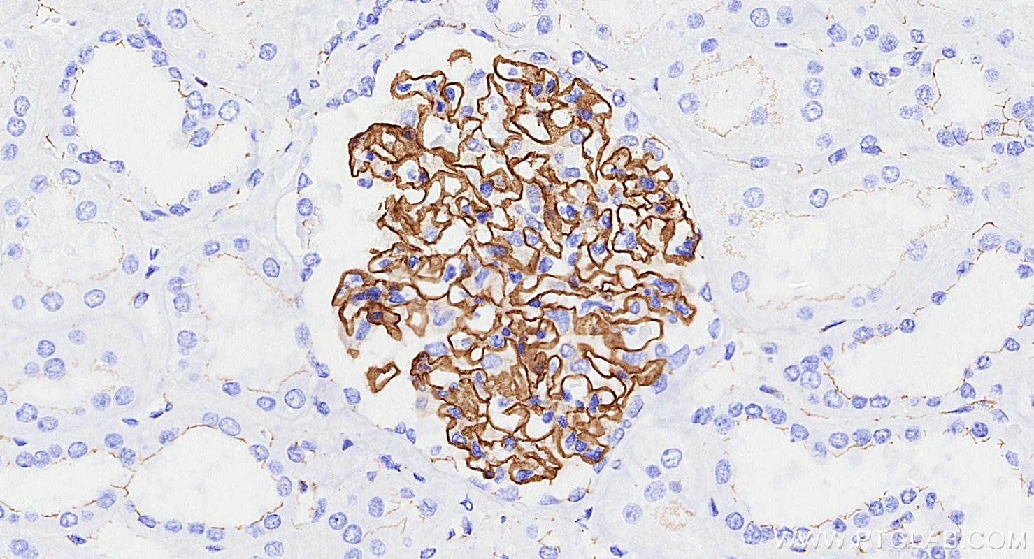 Immunohistochemistry (IHC) staining of human kidney tissue using ZO-1 Recombinant monoclonal antibody (82870-7-RR)