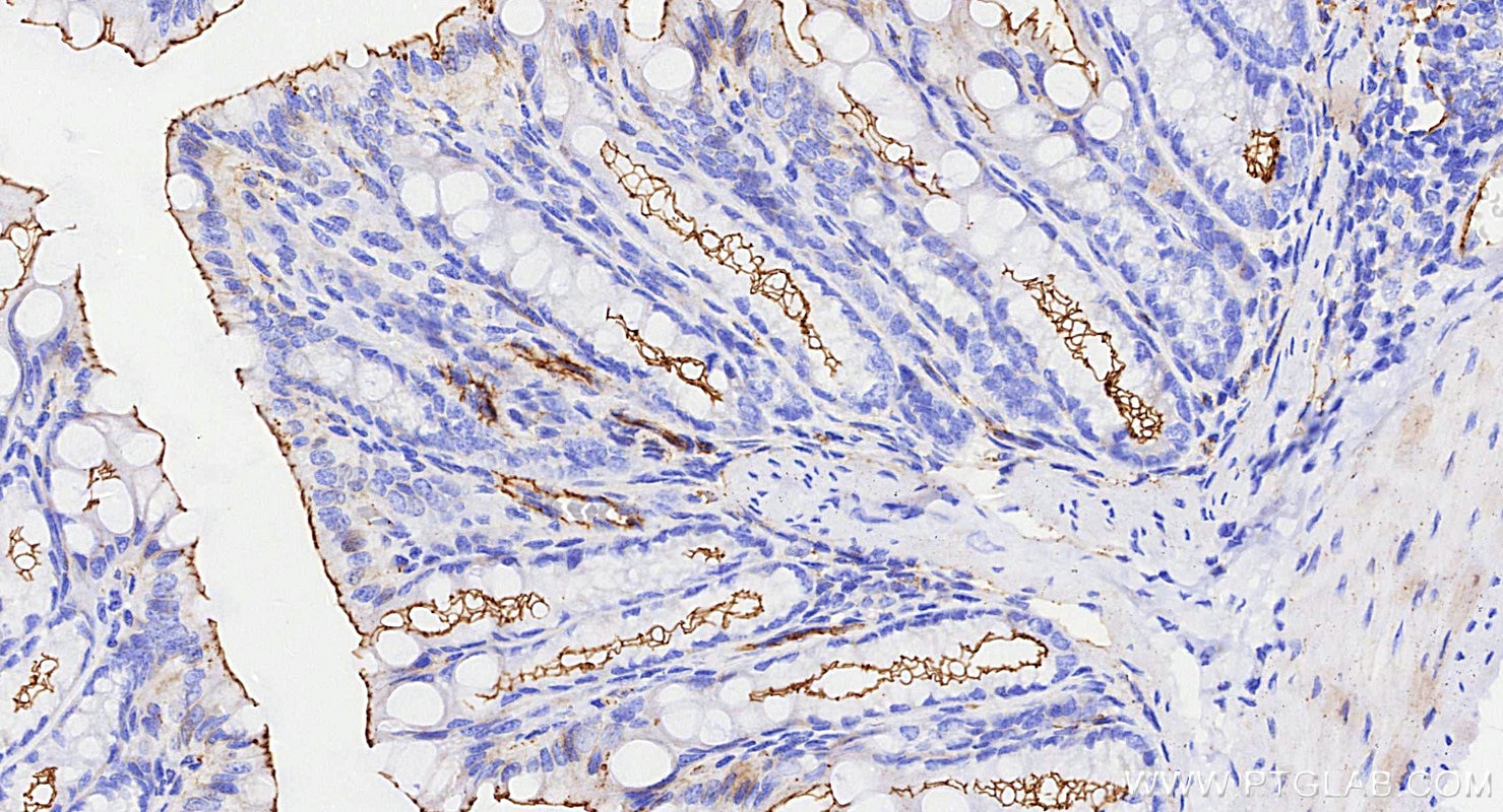 Immunohistochemistry (IHC) staining of mouse colon tissue using ZO-1 Recombinant monoclonal antibody (82870-7-RR)