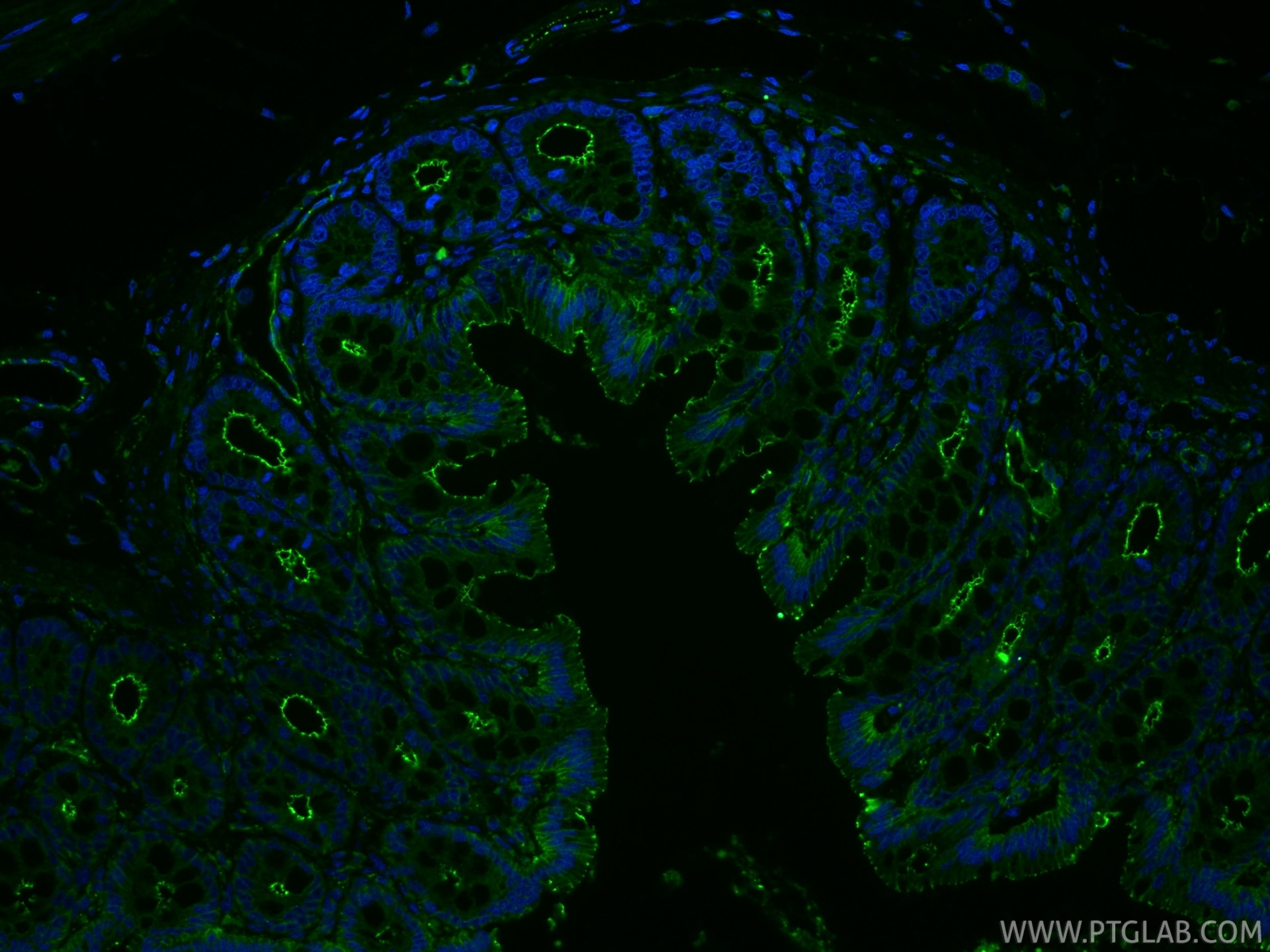 IF Staining of rat colon using RMX00002 Immunofluorescence (IF) / fluorescent staining of rat colon tissue using Multi-rAb® ZO-1 Multi-Recombinant antibody (RMX00002)