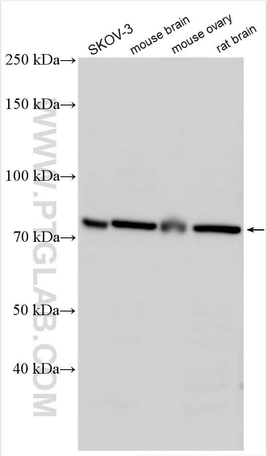 Western Blot (WB) analysis of various lysates using ZP2 Polyclonal antibody (21832-1-AP)