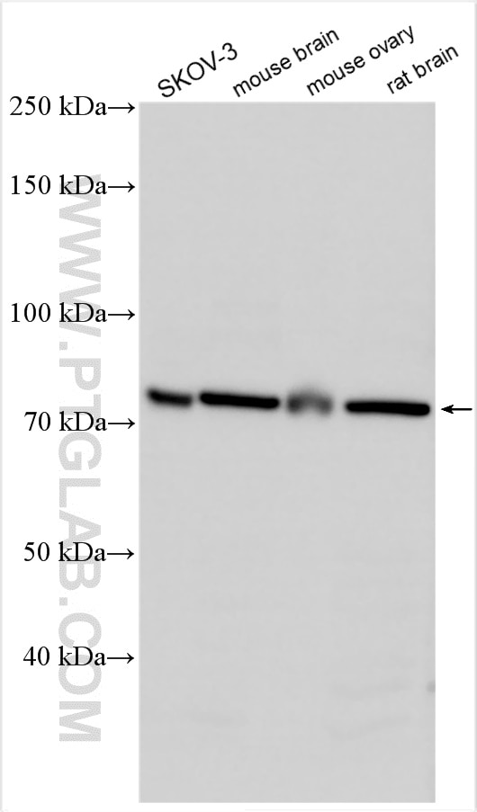 WB analysis using 21832-1-AP