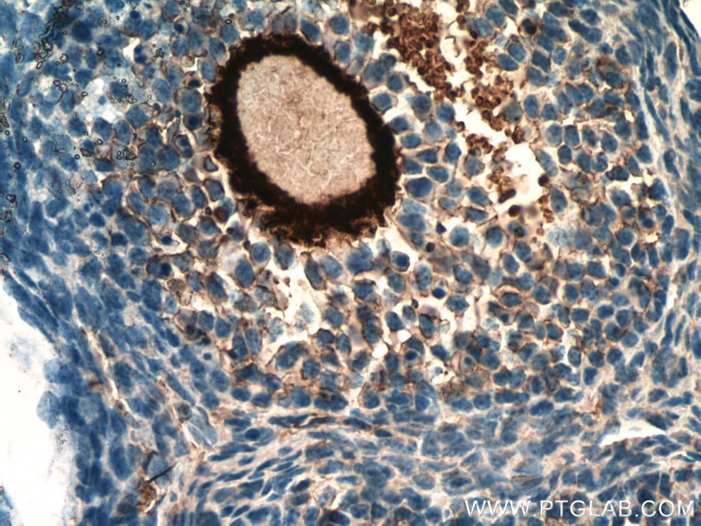 IHC staining of mouse ovary using 21279-1-AP