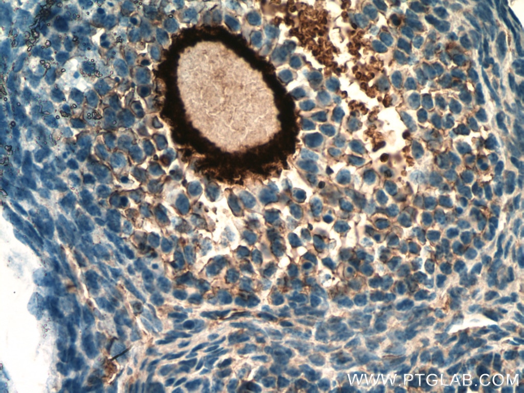 Immunohistochemistry (IHC) staining of mouse ovary tissue using ZP3 Polyclonal antibody (21279-1-AP)