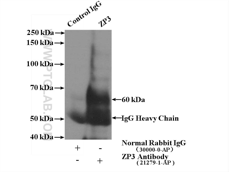 Immunoprecipitation (IP) experiment of HeLa cells using ZP3 Polyclonal antibody (21279-1-AP)