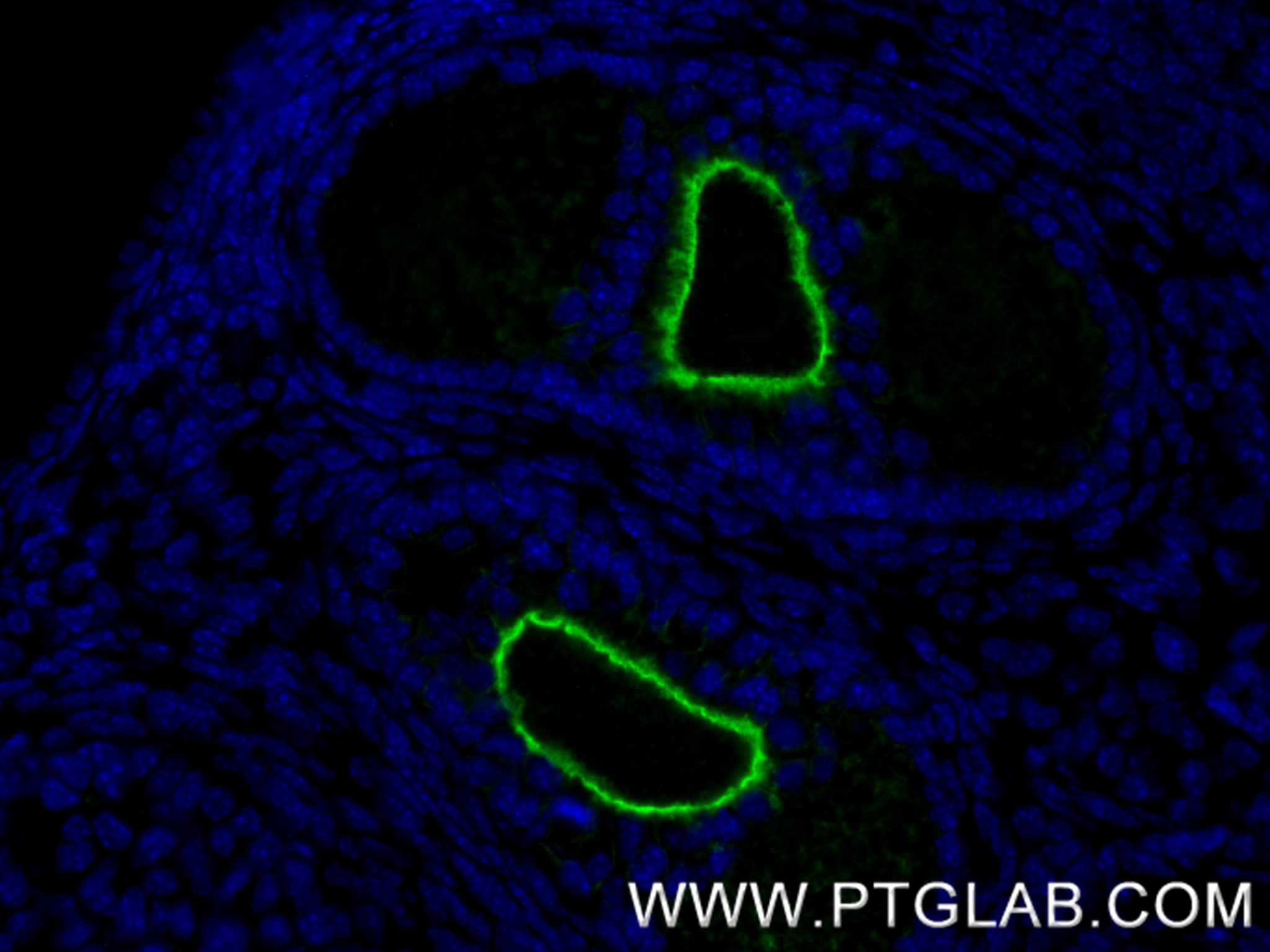Immunofluorescence (IF) / fluorescent staining of mouse ovary tissue using ZP3 Recombinant antibody (85084-1-RR)