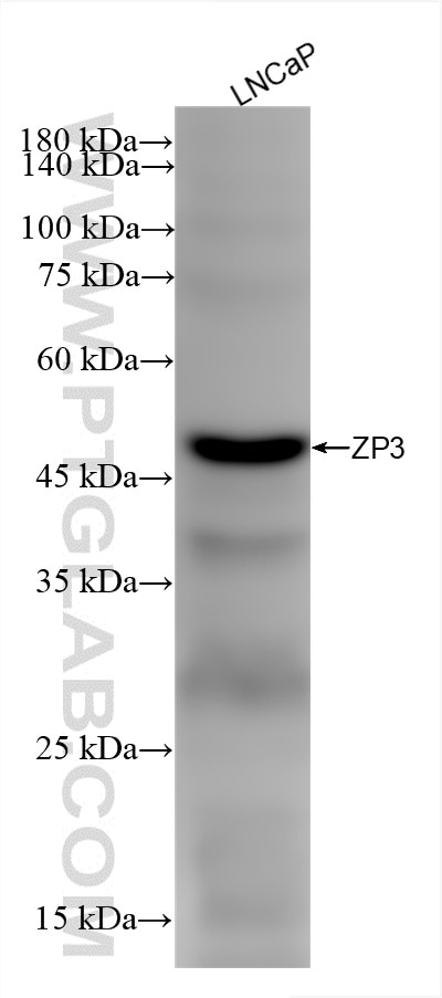 Western Blot (WB) analysis of various lysates using ZP3 Recombinant antibody (85084-1-RR)