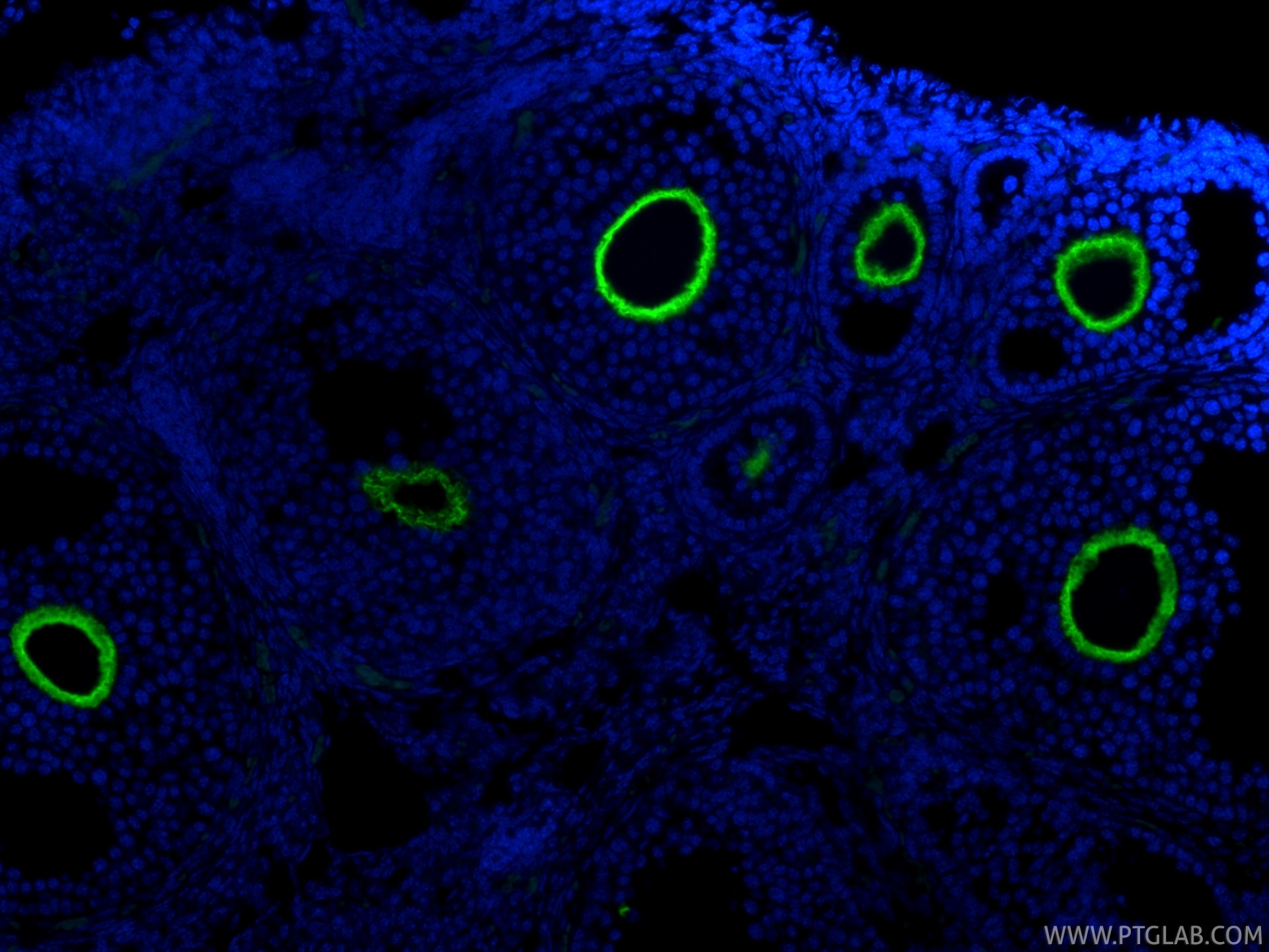 Immunofluorescent analysis of (4% PFA) fixed paraffin-embedded mouse ovary tissue using CoraLite® Plus 488 ZP3 antibody (CL488-85084, Clone: 242729A8 ) at dilution of 1:200. Heat mediated antigen retrieval with Tris-EDTA buffer (pH 9.0). Immunofluorescence (IF) / fluorescent staining of mouse ovary tissue using CoraLite® Plus 488-conjugated ZP3 Recombinant mono (CL488-85084)