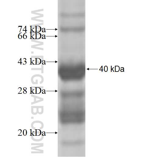 ZPBP2 fusion protein Ag7002 SDS-PAGE