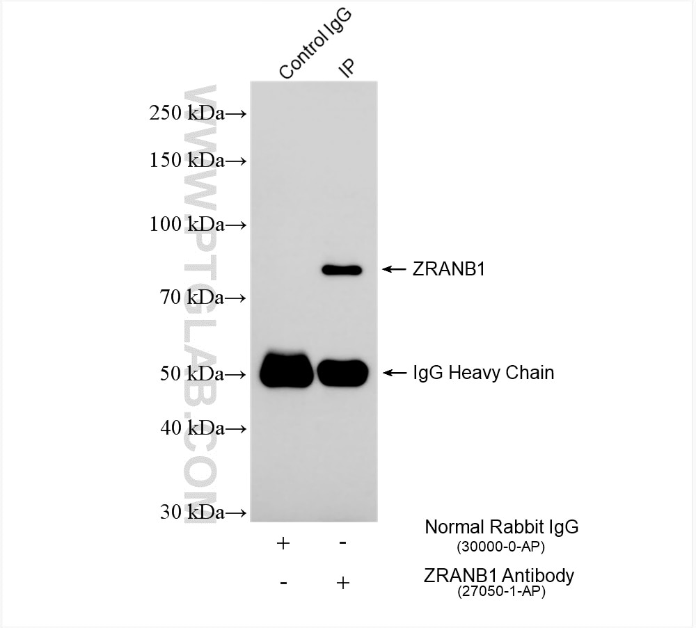 Immunoprecipitation (IP) experiment of HeLa cells using ZRANB1 Polyclonal antibody (27050-1-AP)