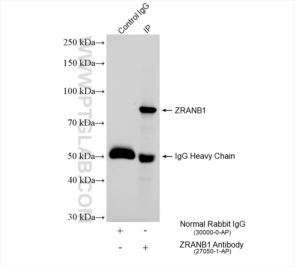 Immunoprecipitation (IP) experiment of mouse cerebellum tissue using ZRANB1 Polyclonal antibody (27050-1-AP)