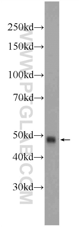 Western Blot (WB) analysis of Jurkat cells using ZRANB2 Polyclonal antibody (24816-1-AP)