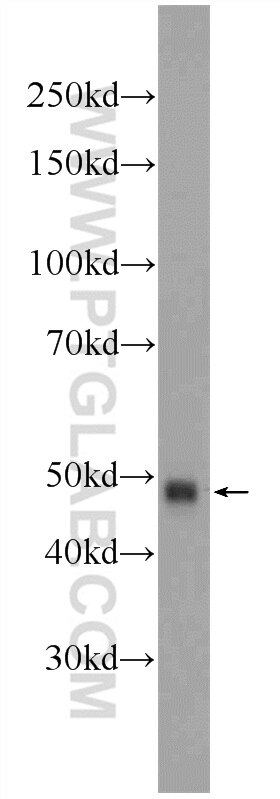 WB analysis of Jurkat using 24816-1-AP