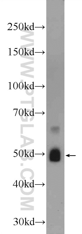 Western Blot (WB) analysis of NIH/3T3 cells using ZRANB2 Polyclonal antibody (24816-1-AP)