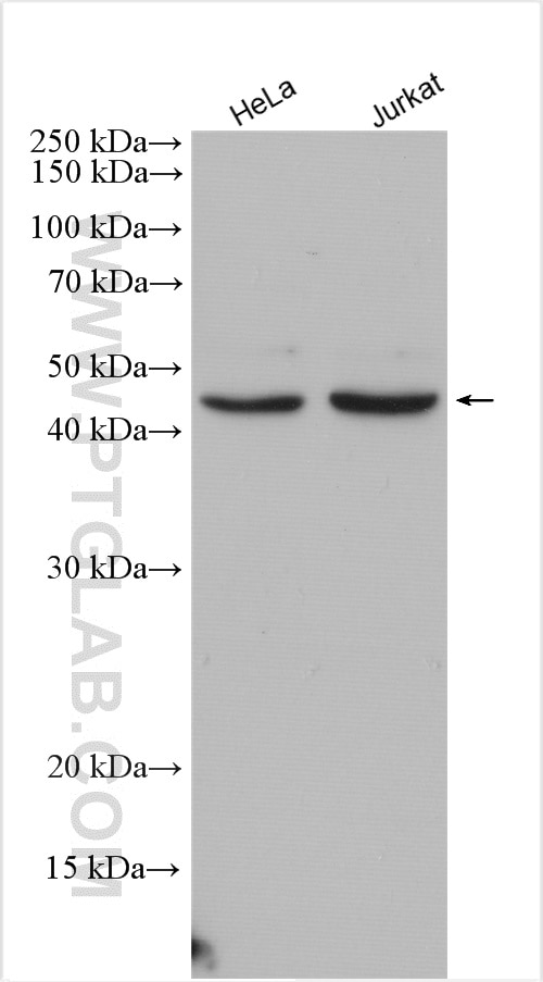 Western Blot (WB) analysis of various lysates using ZRANB2 Polyclonal antibody (24816-1-AP)