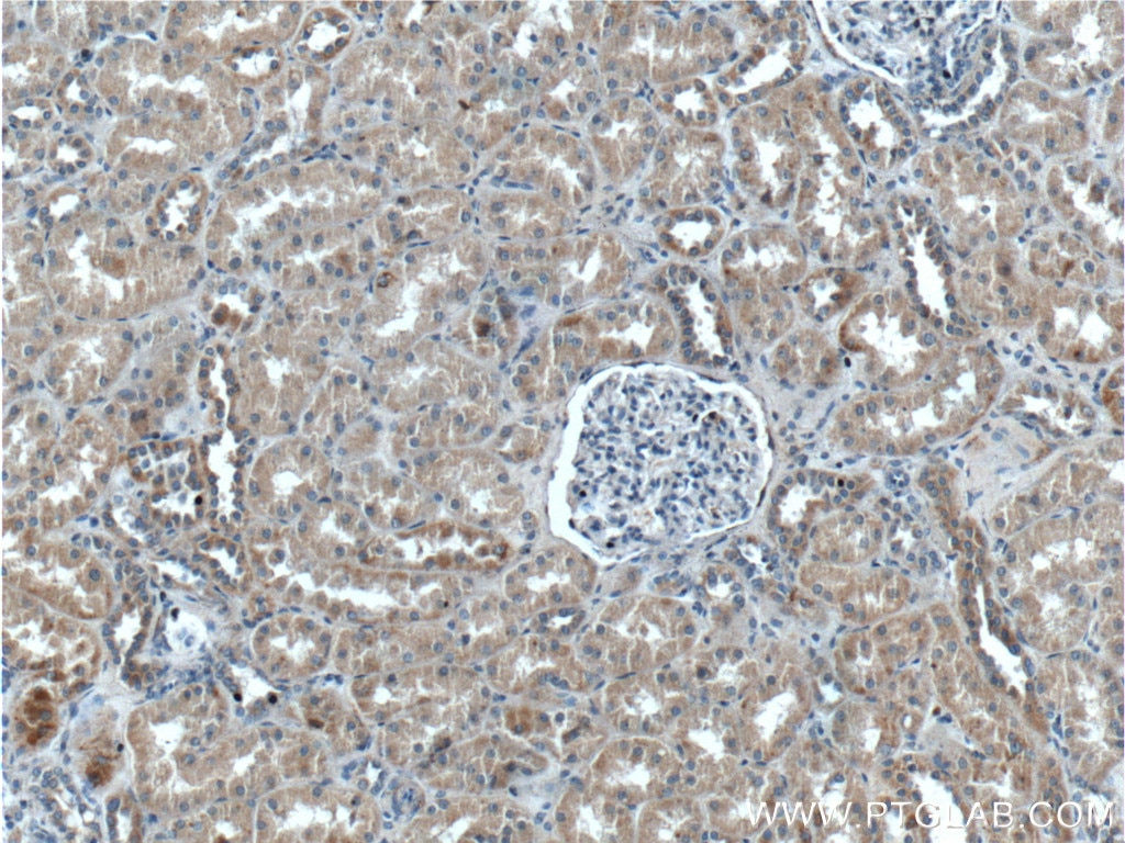 Immunohistochemistry (IHC) staining of human kidney tissue using ZRANB3 Polyclonal antibody (23111-1-AP)