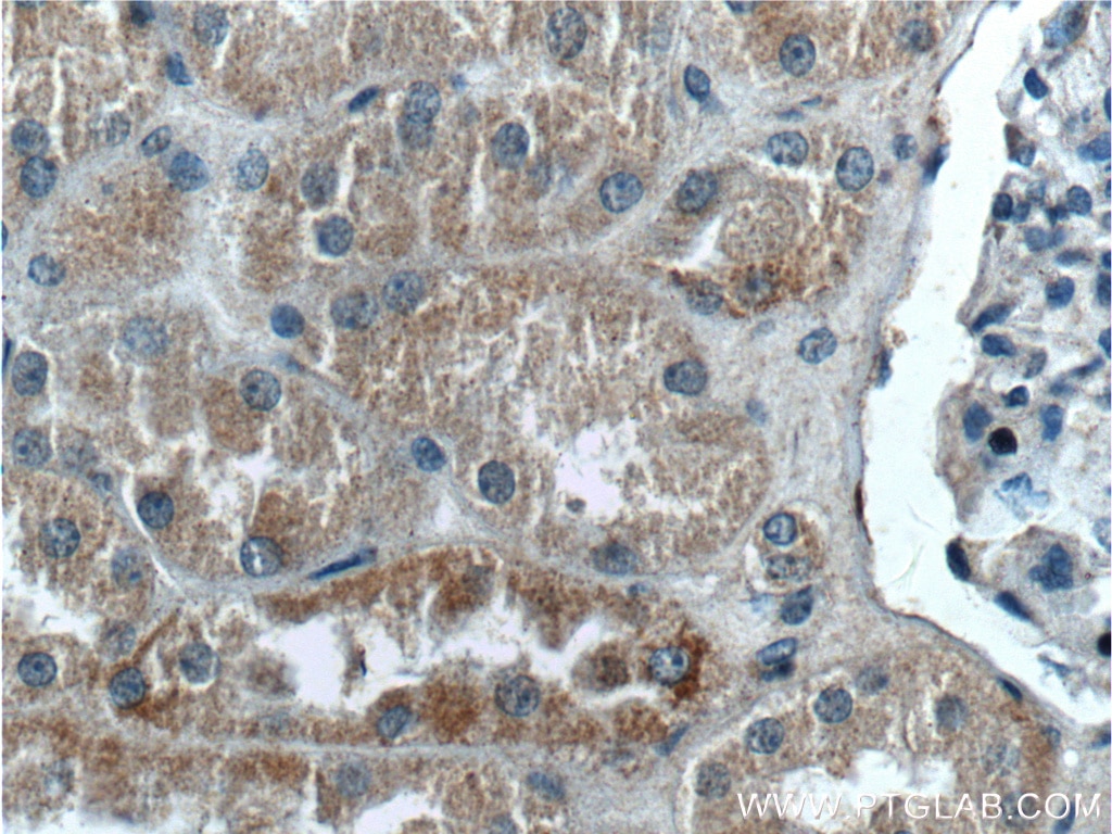 Immunohistochemistry (IHC) staining of human kidney tissue using ZRANB3 Polyclonal antibody (23111-1-AP)