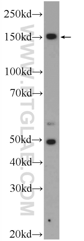 Western Blot (WB) analysis of HEK-293 cells using ZRANB3 Polyclonal antibody (23111-1-AP)