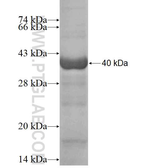 ZRANB3 fusion protein Ag19407 SDS-PAGE