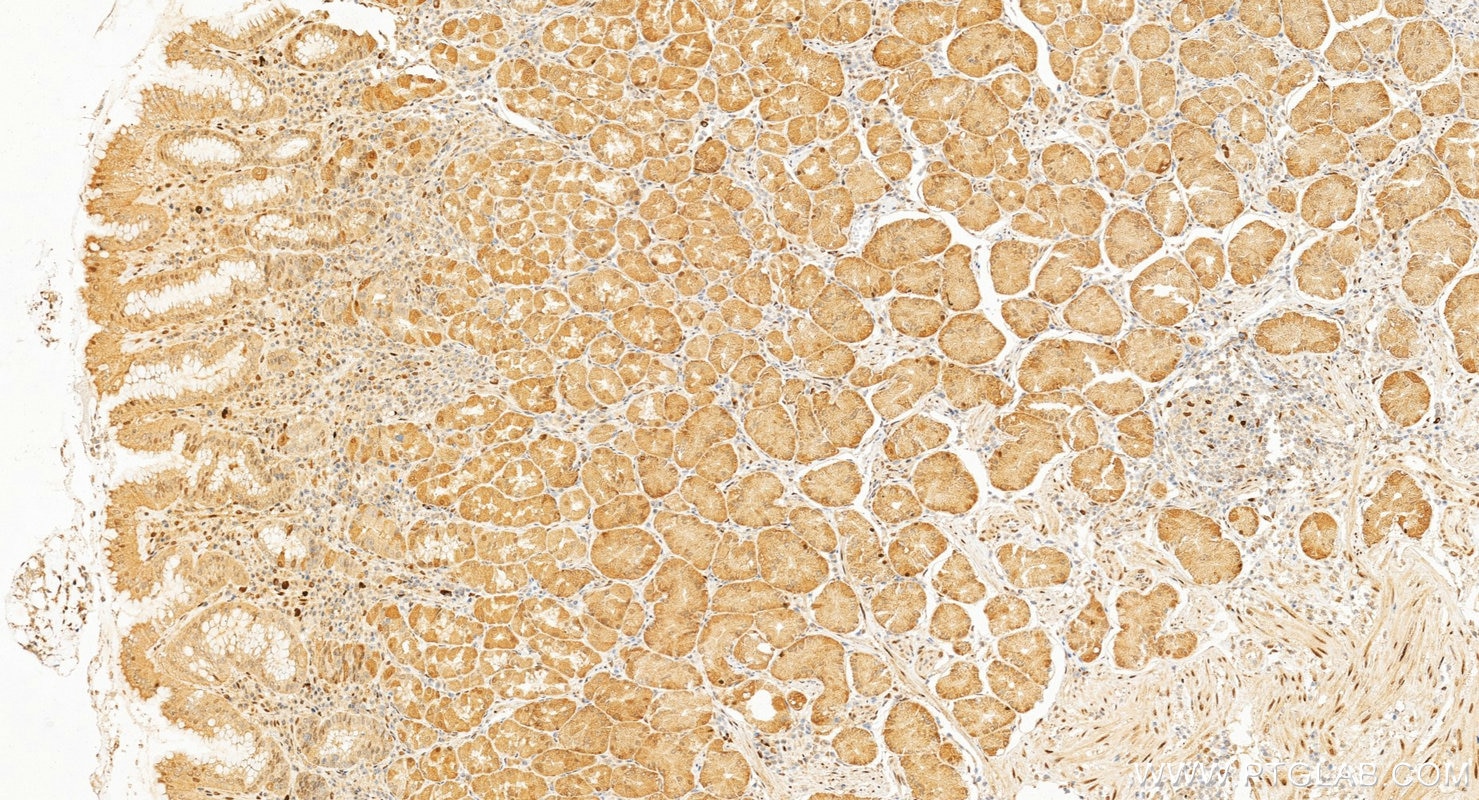 IHC staining of human stomach using 30704-1-AP Immunohistochemistry (IHC) staining of human stomach tissue using ZSCAN18 Polyclonal antibody (30704-1-AP)