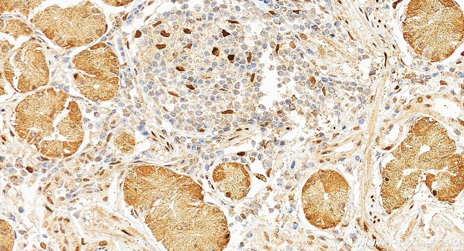 IHC staining of human stomach using 30704-1-AP Immunohistochemistry (IHC) staining of human stomach tissue using ZSCAN18 Polyclonal antibody (30704-1-AP)