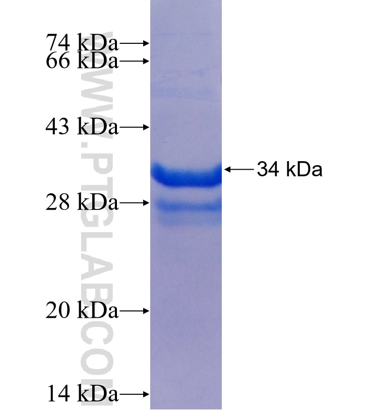 ZSCAN18 fusion protein Ag25543 SDS-PAGE