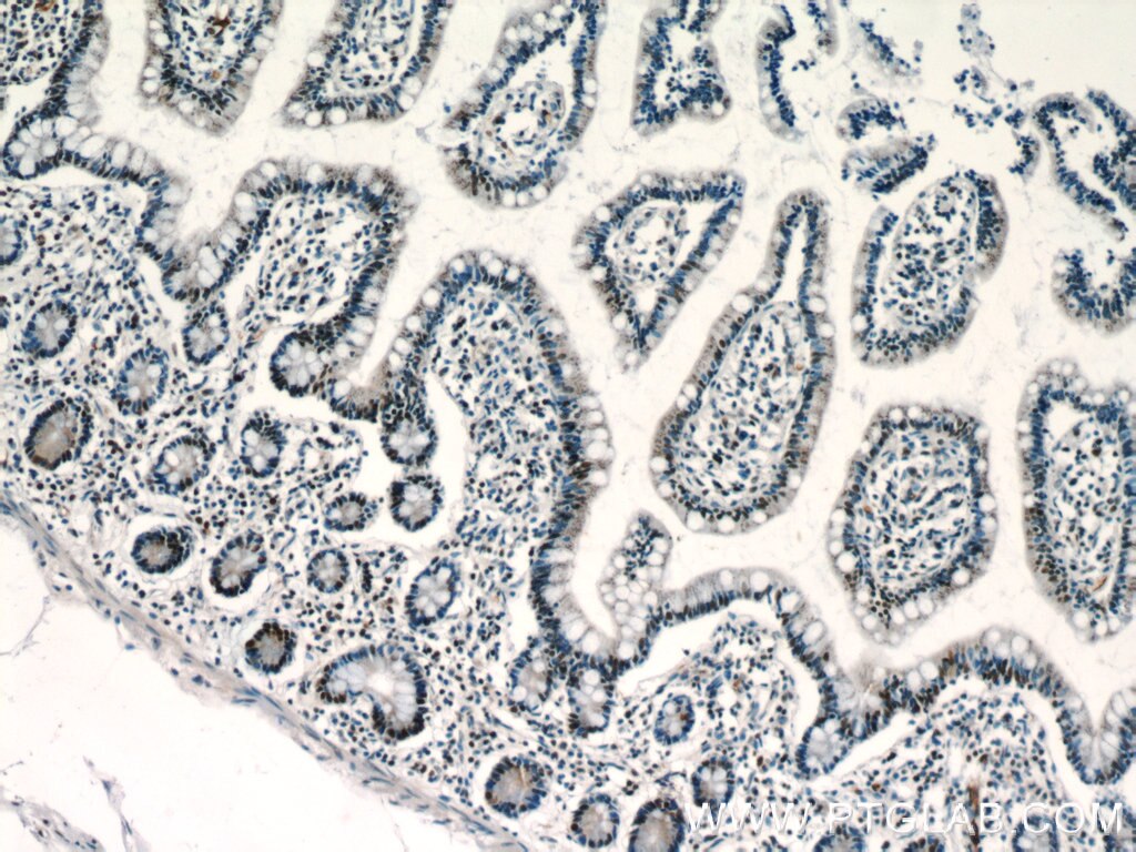 Immunohistochemistry (IHC) staining of human small intestine tissue using ZSCAN20 Polyclonal antibody (20855-1-AP)