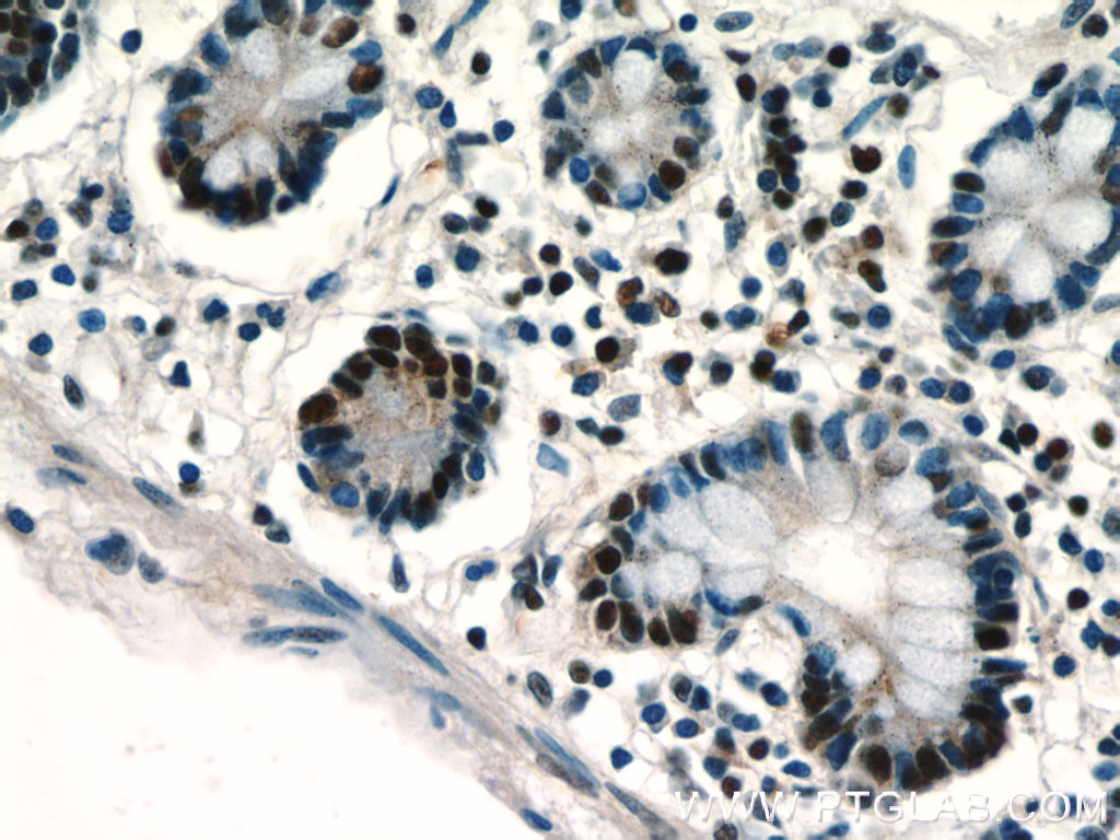 Immunohistochemistry (IHC) staining of human small intestine tissue using ZSCAN20 Polyclonal antibody (20855-1-AP)
