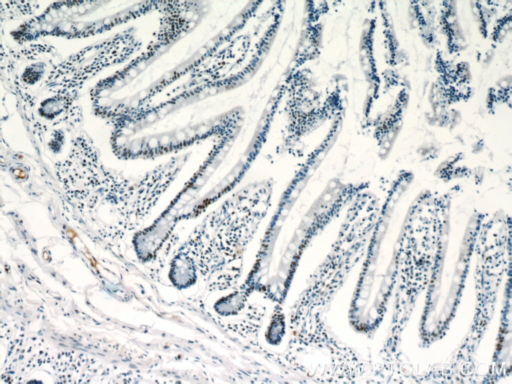 IHC staining of human small intestine using 20855-1-AP