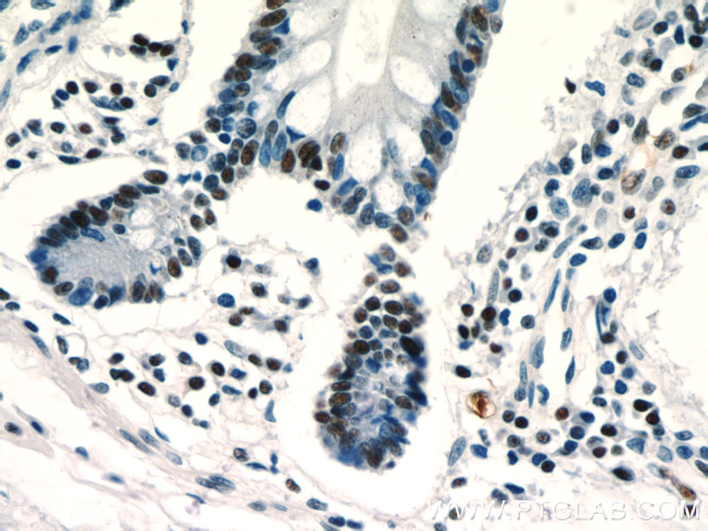 Immunohistochemistry (IHC) staining of human small intestine tissue using ZSCAN20 Polyclonal antibody (20855-1-AP)