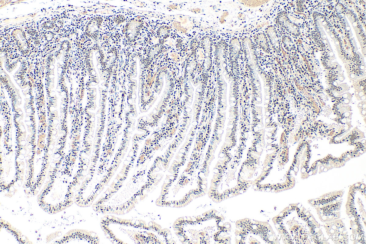 Immunohistochemistry (IHC) staining of human small intestine tissue using ZSCAN20 Polyclonal antibody (20855-1-AP)