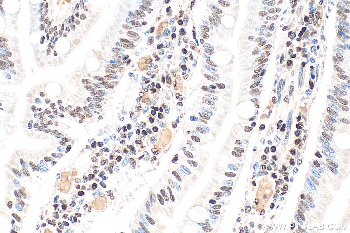 Immunohistochemistry (IHC) staining of human small intestine tissue using ZSCAN20 Polyclonal antibody (20855-1-AP)