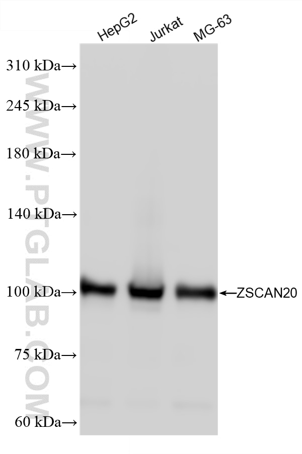 Western Blot (WB) analysis of various lysates using ZSCAN20 Polyclonal antibody (20855-1-AP)