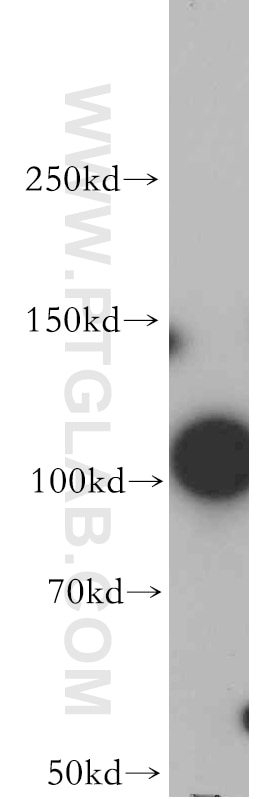 Western Blot (WB) analysis of Jurkat cells using ZSCAN20 Polyclonal antibody (20855-1-AP)