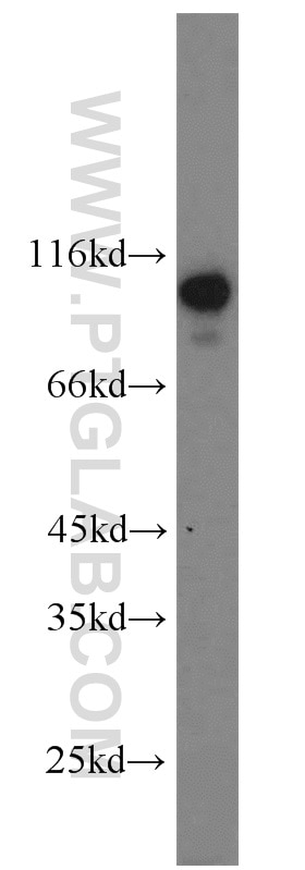 Western Blot (WB) analysis of Jurkat cells using ZSCAN20 Polyclonal antibody (20855-1-AP)
