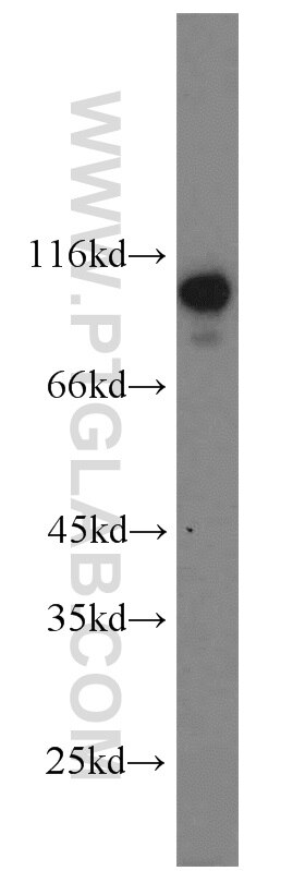 WB analysis of Jurkat using 20855-1-AP