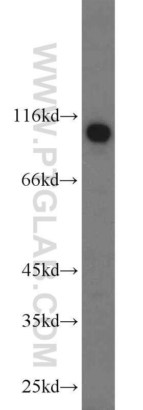 Western Blot (WB) analysis of HepG2 cells using ZSCAN20 Polyclonal antibody (20855-1-AP)