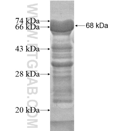 ZSCAN20 fusion protein Ag14798 SDS-PAGE