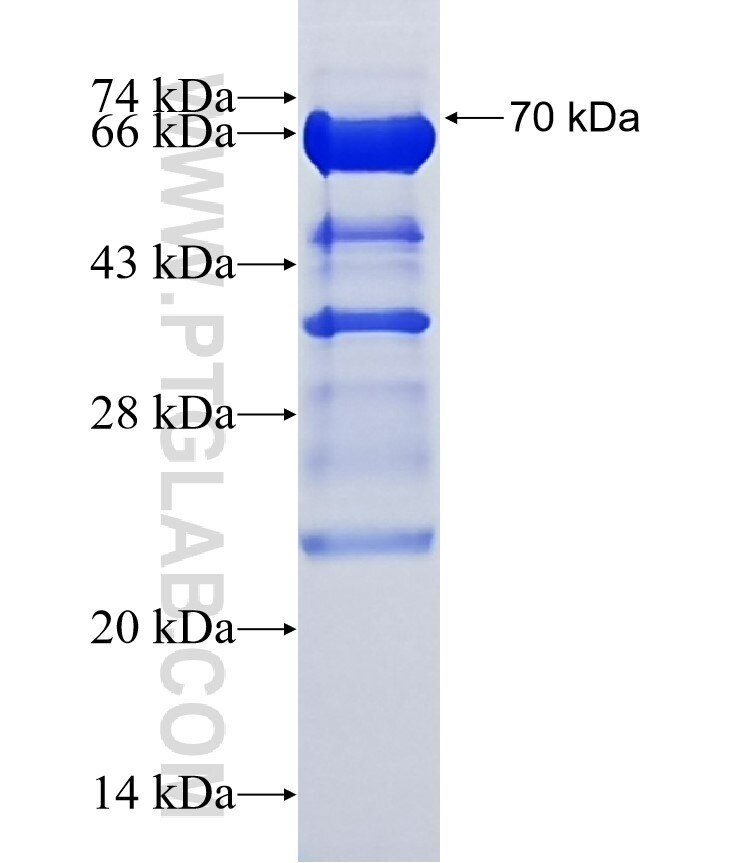 ZSCAN20 fusion protein Ag14798 SDS-PAGE